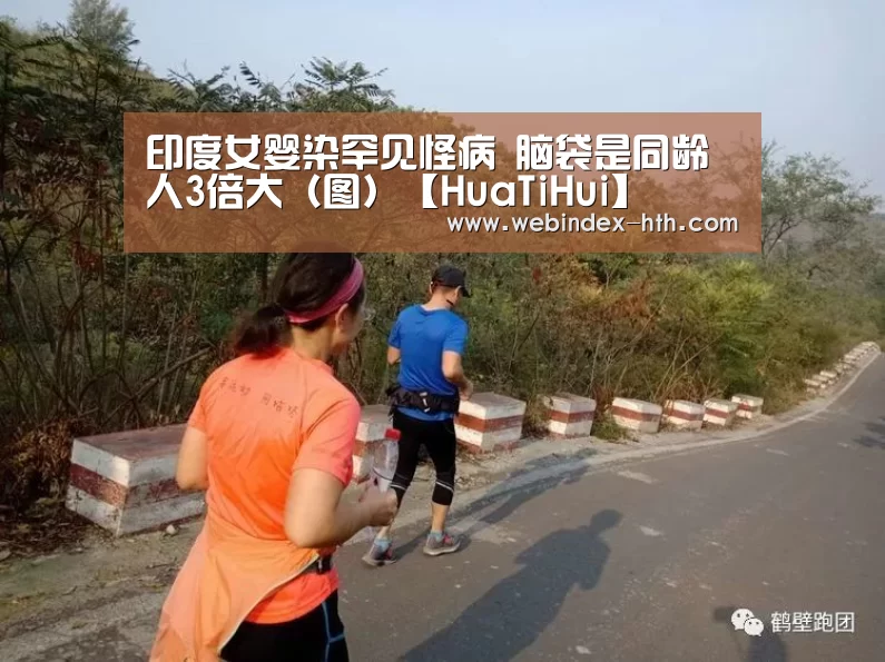 印度女婴染罕见怪病 脑袋是同龄人3倍大（图）【HuaTiHu